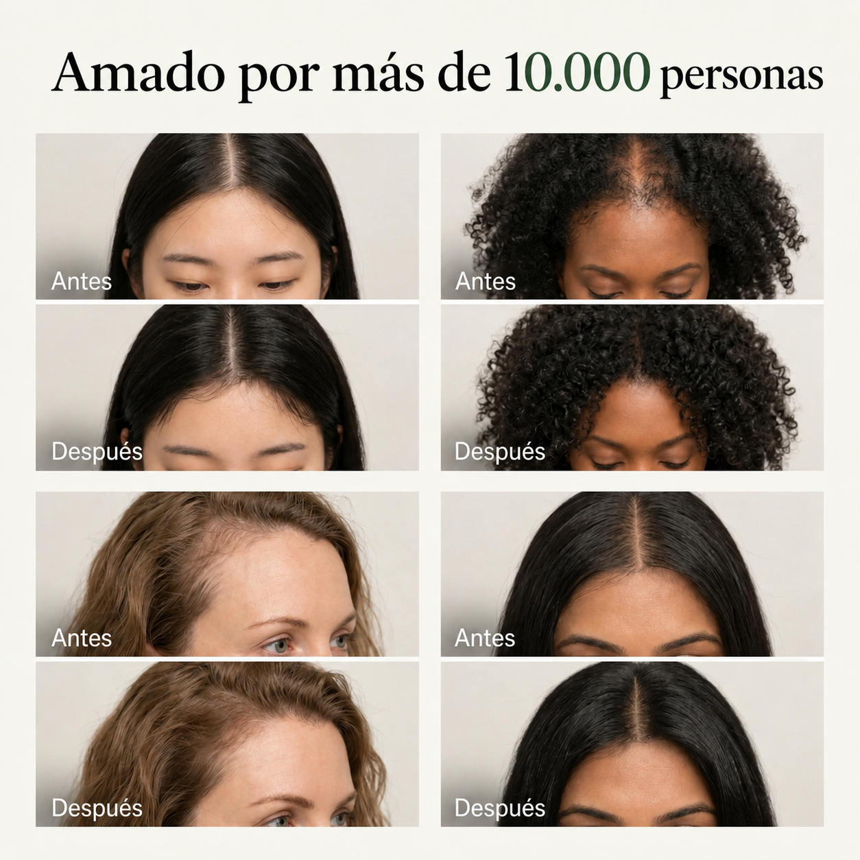Barra Coreana - YaraCare